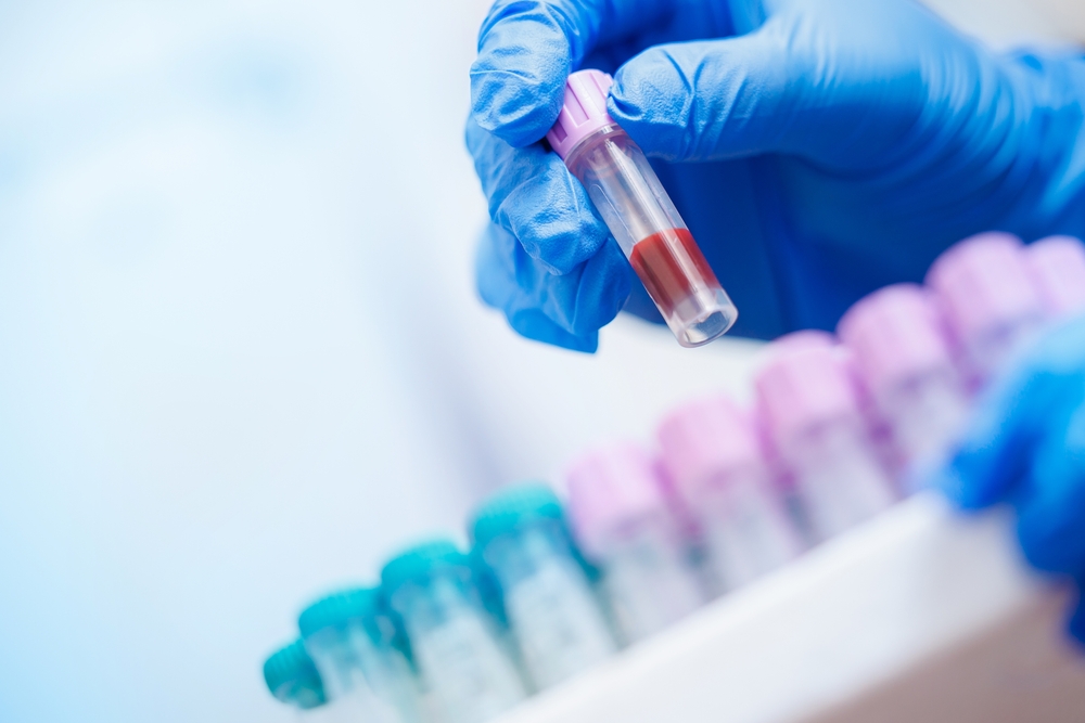 Gloved,Hands,Holding,Blood,Sample,At,Veterinary,Clinic,Laboratory.